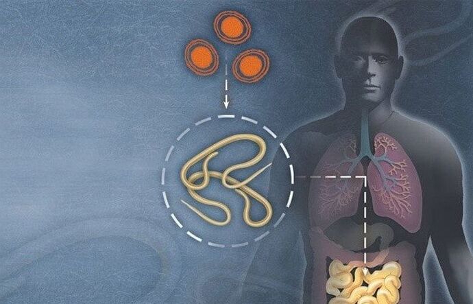 Parassiti nell'intestino umano
