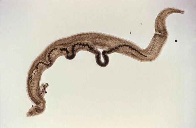 Parassita Schistosoma all'interno del corpo