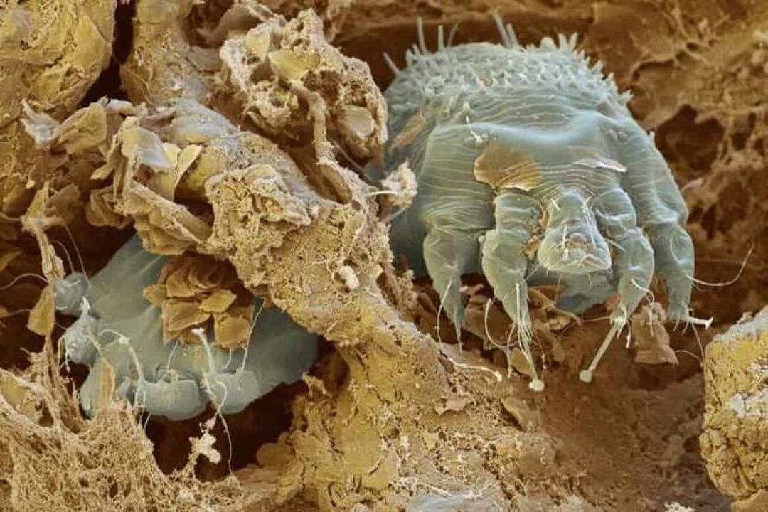 acaro della scabbia al microscopio