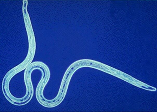 nematodi nel corpo umano