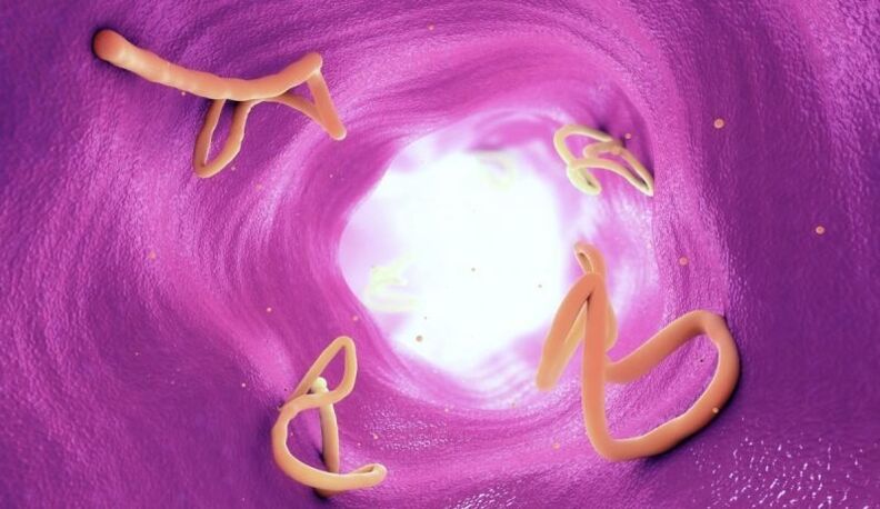 Elminti nell'intestino umano