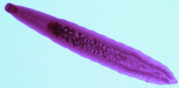 parassita del colpo di fortuna dal corpo umano